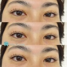 eyelash