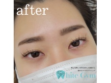 Before → After!!