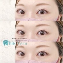 #まつエク#フラットラッシュ
