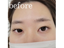 Before → After!!