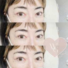 ♯ラッシュリフト♯まつパ